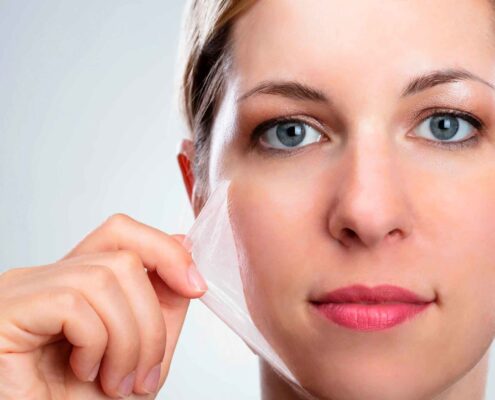 Cual es la mejor época del año para realizar los tratamientos de peeling facial?